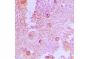 Immunohistochemical analysis of AS160 (pT642) staining in human brain formalin fixed paraffin embedded tissue section. (TBC1D4 抗体  (pSer642))