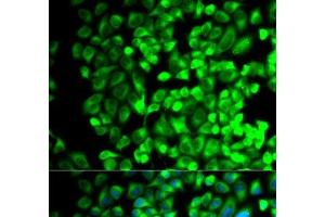 Immunofluorescence analysis of HeLa cells using TBXAS1 Polyclonal Antibody (TBXAS1 抗体)