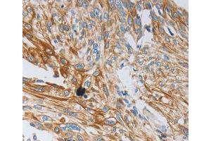 Immunohistochemistry (IHC) image for anti-Neurotrophin 3 (NTF3) antibody (ABIN3017532) (Neurotrophin 3 抗体)