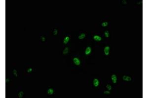 Immunofluorescence staining of Hela cells with ABIN7127716 at 1:100,counter-stained with DAPI. (Recombinant MYB 抗体  (pSer11))