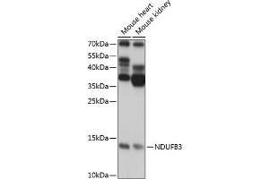 Western blot analysis of extracts of various cell lines, using NDUFB3 antibody (ABIN7268810) at 1:1000 dilution. (NDUFB3 抗体  (AA 1-98))