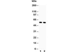 Western blot testing of GLUT4 antibody and Lane 1:  rat heart;  2: rat skeletal muscle (GLUT4 抗体  (AA 333-509))