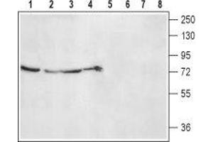 Western blot analysis of rat kidney (lanes 1 and 5), lung (lanes 2 and 6), liver (lanes 3 and 7) lysates and rat skeletal muscle membranes (lanes 4 and 8): - 1-4. (ADRA2B 抗体  (2nd Extracellular Loop, Cys169))