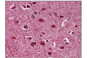 Immunohistochemistry (IHC) image for anti-Myelin Associated Glycoprotein (MAG) (AA 119-209) antibody (ABIN782426) (MAG 抗体  (AA 119-209))