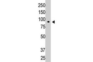 Western blot analysis of CBLC polyclonal antibody  in K-562 cell lysate. (CBLC 抗体  (N-Term))