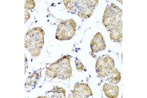 Immunohistochemistry of paraffin-embedded human gastric using STK3 antibody at dilution of 1:100 (x40 lens). (STK3 抗体)