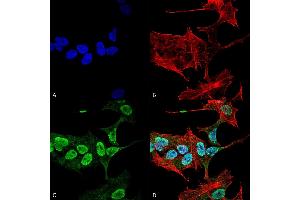 Immunocytochemistry/Immunofluorescence analysis using Mouse Anti-Alpha Synuclein Monoclonal Antibody, Clone 3C11 (ABIN5564055).
