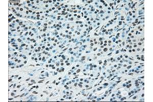 Immunohistochemical staining of paraffin-embedded Ovary tissue using anti-BRAFmouse monoclonal antibody. (BRAF 抗体)