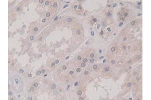 Immunohistochemistry (IHC) image for anti-Kinesin Family Member 18A (KIF18A) (AA 1-453) antibody (ABIN7436060)
