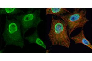 ICC/IF Image PGAM2 antibody detects PGAM2 protein at cytoplasm and nucleus by immunofluorescent analysis. (PGAM2 抗体)