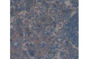 IHC-P analysis of spleen tissue, with DAB staining. (Protein phosphatase 1 (AA 335-578), (Regulatory Subunit 15A) 抗体)