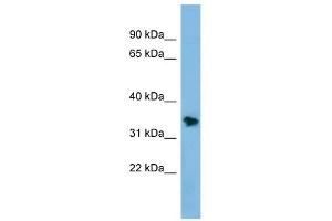 NSMCE1 antibody used at 1 ug/ml to detect target protein. (NSMCE1 抗体)