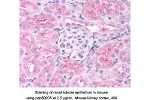 Image no. 1 for anti-Egl-9 Family Hypoxia Inducible Factor 1 (EGLN1) (AA 300-400) antibody (ABIN363514) (EGLN1 抗体  (AA 300-400))