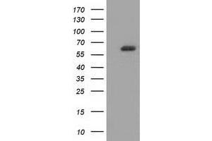 Western Blotting (WB) image for anti-Guanylate Binding Protein 5 (GBP5) antibody (ABIN1498408) (GBP5 抗体)