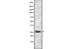 Western blot analysis NET-5 using HeLa whole cell lysates (Tetraspanin 9 抗体  (Internal Region))