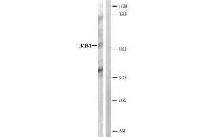 Western blot analysis of extracts from CV-1 cells treated with forsklin. (LKB1 抗体)