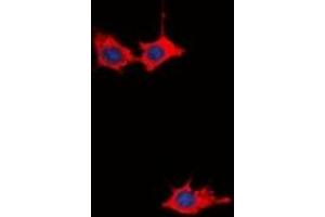 Immunofluorescent analysis of GRB10 staining in HepG2 cells. (GRB10 抗体  (N-Term))