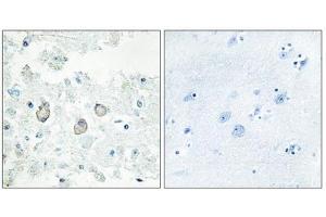 Immunohistochemistry analysis of paraffin-embedded human brain tissue using DOK7 antibody. (DOK7 抗体  (N-Term))