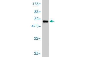 Western Blotting (WB) image for anti-Nicotinamide Nucleotide Transhydrogenase (NNT) (AA 1-207) antibody (ABIN565110)