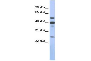 WB Suggested Anti-MMP13 Antibody Titration: 0. (MMP13 抗体  (Middle Region))