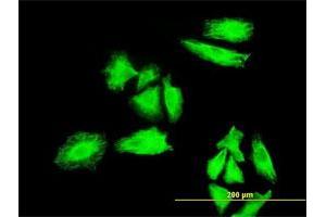Immunofluorescence of monoclonal antibody to MKNK1 on HeLa cell. (MKNK1 抗体  (AA 1-465))