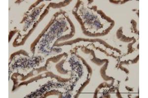 Image no. 3 for anti-Cell Death-Inducing DFFA-Like Effector B (CIDEB) (AA 3-111) antibody (ABIN599215) (CIDEB 抗体  (AA 3-111))
