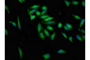Immunofluorescence staining of Hela cells with ABIN7157558 at 1:100, counter-stained with DAPI. (KSR2 抗体  (AA 159-296))