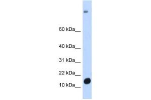 Western Blotting (WB) image for anti-Chromosome 6 Open Reading Frame 201 (C6orf201) antibody (ABIN2458562) (C6orf201 抗体)