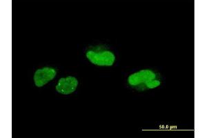 Immunofluorescence of monoclonal antibody to SCAND1 on HeLa cell. (SCAND1 抗体  (AA 1-179))