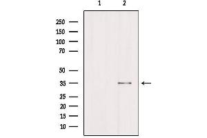 Western blot analysis of extracts from Hela, using FCGR2A Antibody. (FCGR2A 抗体  (C-Term))