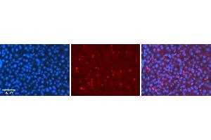 Rabbit Anti-MLX Antibody   Formalin Fixed Paraffin Embedded Tissue: Human Liver Tissue Observed Staining: Cytoplasm in speckles in hepatocytes Primary Antibody Concentration: 1:100 Other Working Concentrations: 1:600 Secondary Antibody: Donkey anti-Rabbit-Cy3 Secondary Antibody Concentration: 1:200 Magnification: 20X Exposure Time: 0. (MLX 抗体  (C-Term))