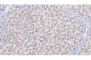 Detection of VDAC1 in Human Liver Tissue using Monoclonal Antibody to Voltage Dependent Anion Channel Protein 1 (VDAC1)