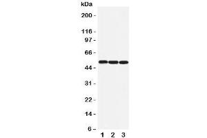 Western blot testing of beta Arrestin 1 antibody and Lane 1:  rat lung;  2: rat skeletal muscle;  3: human SW620 cell lysate (beta Arrestin 1 抗体  (N-Term))