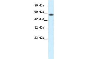 Human Jurkat; WB Suggested Anti-PCYOX1 Antibody Titration: 0. (PCYOX1 抗体  (C-Term))