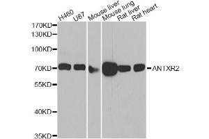 Western blot analysis of extracts of various cell lines, using ANTXR2 antibody. (ANTXR2 抗体)