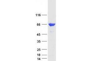 Validation with Western Blot