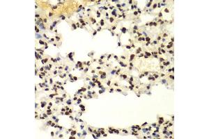 Immunohistochemistry (IHC) image for anti-Small Ubiquitin Related Modifier 2 (SUMO2) (AA 1-95) antibody (ABIN6148726)