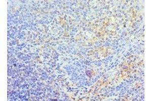 Immunohistochemistry of paraffin-embedded human tonsil tissue using ABIN7172210 at dilution of 1:100 (TFPI2 抗体  (AA 23-235))