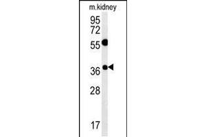 Western blot analysis in mouse kidney tissue lysates (15ug/lane). (Tetraspanin 3 抗体  (AA 90-117))