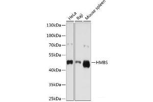 Western blot analysis of extracts of various cell lines using HMBS Polyclonal Antibody at dilution of 1:1000. (HMBS 抗体)