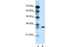 WB Suggested Anti-TSFM Antibody Titration:  1. (TSFM 抗体  (C-Term))
