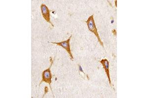 (ABIN6243055 and ABIN6577107) staining B in human brain sections by Immunohistochemistry (IHC-P - paraformaldehyde-fixed, paraffin-embedded sections). (BCAP31 抗体  (AA 1-246))