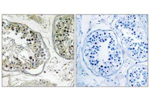 Immunohistochemistry analysis of paraffin-embedded human testis tissue, using CHST13 antibody. (CHST13 抗体  (Internal Region))