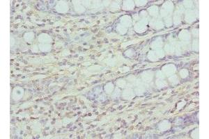 Immunohistochemistry of paraffin-embedded human colon tissue using ABIN7147359 at dilution of 1:100 (CG1331 Gene Product From Transcript CG1331-RA (CCP84AF) (AA 1-280) 抗体)
