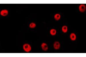ABIN6274044 staining Hela by IF/ICC. (RNF20 抗体  (Internal Region))