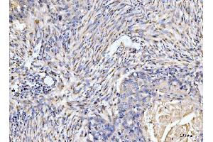 IHC analysis of Giantin/GOLGB1 using anti-Giantin/GOLGB1 antibody (ABIN7600139).