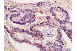Immunohistochemistry (IHC) image for anti-Heat Shock Protein 90kDa alpha (Cytosolic), Class B Member 1 (HSP90AB1) (AA 601-732) antibody (ABIN672021)