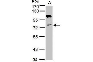 WB Image Sample(30 ug whole cell lysate) A:A431, 7. (Adenylate Kinase 7 抗体)