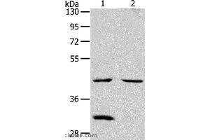 Western blot analysis of Mouse kidney and heart tissue, using NCEH1 Polyclonal Antibody at dilution of 1:1300 (NCEH1 抗体)