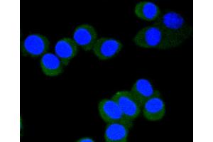 SH-SY-5Y cells were fixed in paraformaldehyde, permeabilized with 0. (EIF4E 抗体  (pSer209))